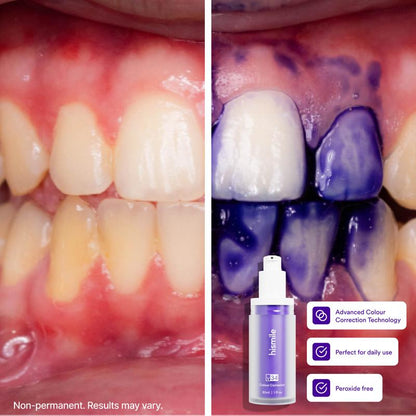Hismile V34 Teeth Whitening Colour Corrector Serum 30ml