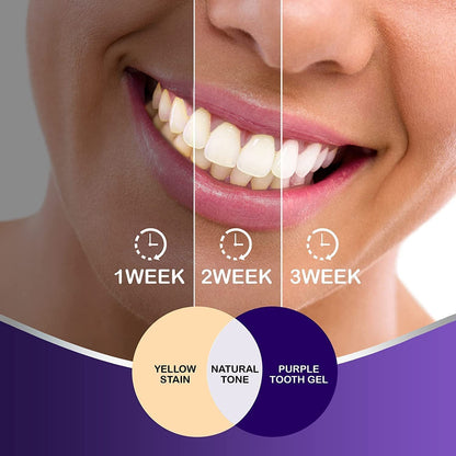 Hismile V34 Teeth Whitening Colour Corrector Serum 30ml